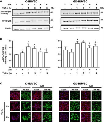 Effect of the Human Amniotic Membrane on the Umbilical Vein Endothelial Cells of Gestational Diabetic Mothers: New Insight on Inflammation and Angiogenesis